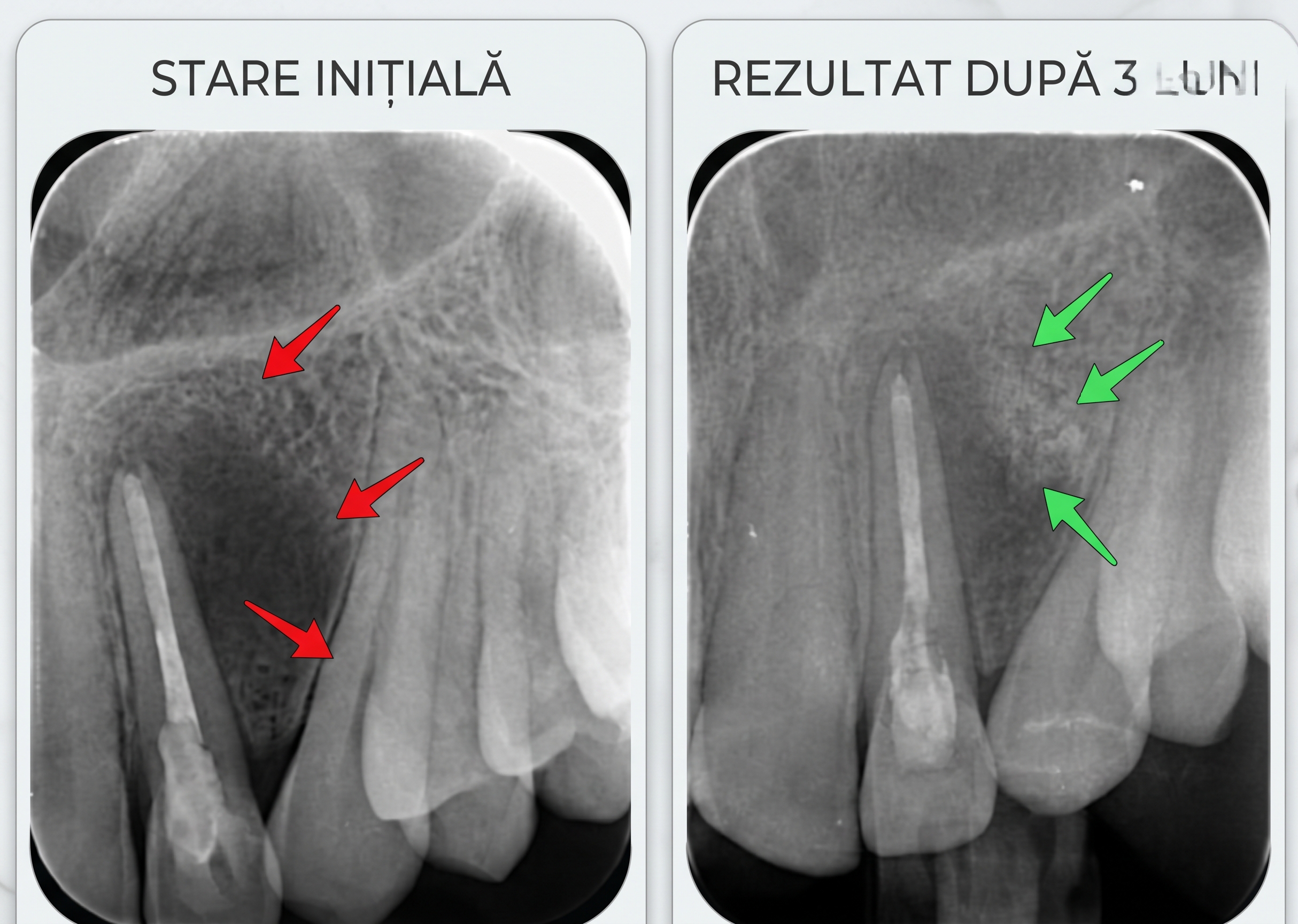 „Scoateți-l, vă rog!” Dar durerea nu înseamnă mereu că dintele e pierdut